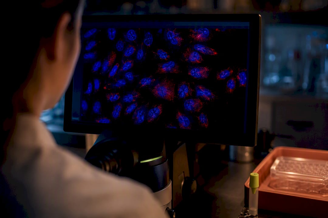 Fluorescence microscopy of inflammatory cell signaling