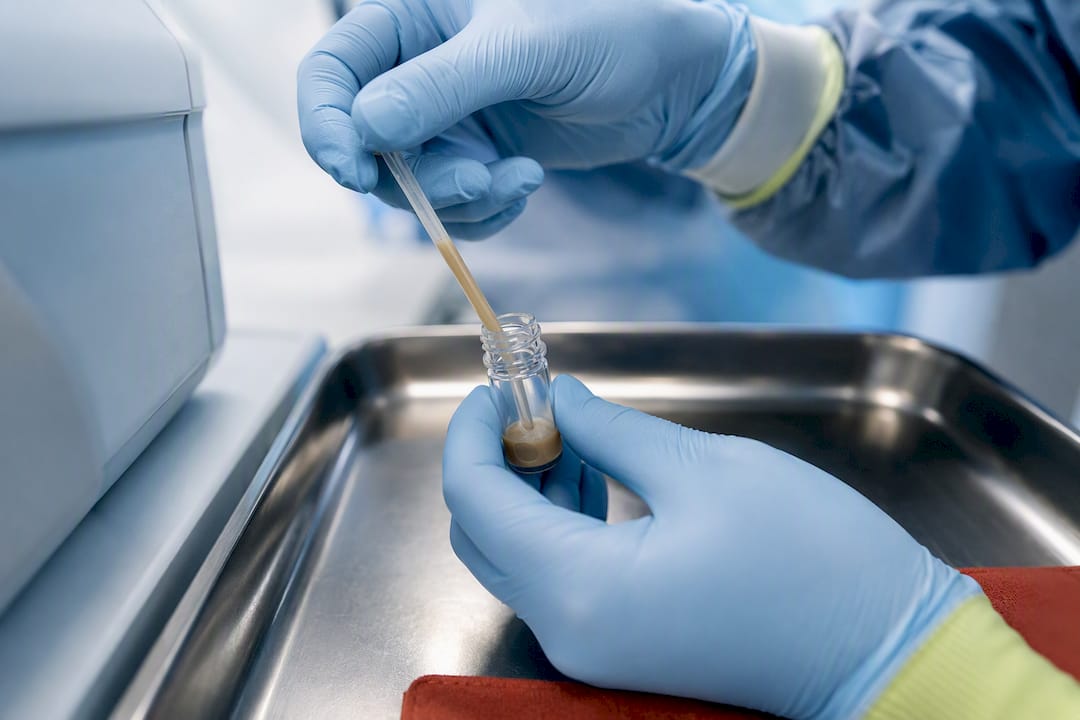 Clinician handling small bowel microbiome sample